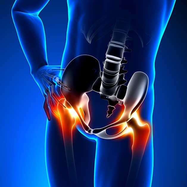 Dolore all’anca e/o alla gambe ?  Fisiochinesiterapia abbinato ai Massaggi Decontratturanti