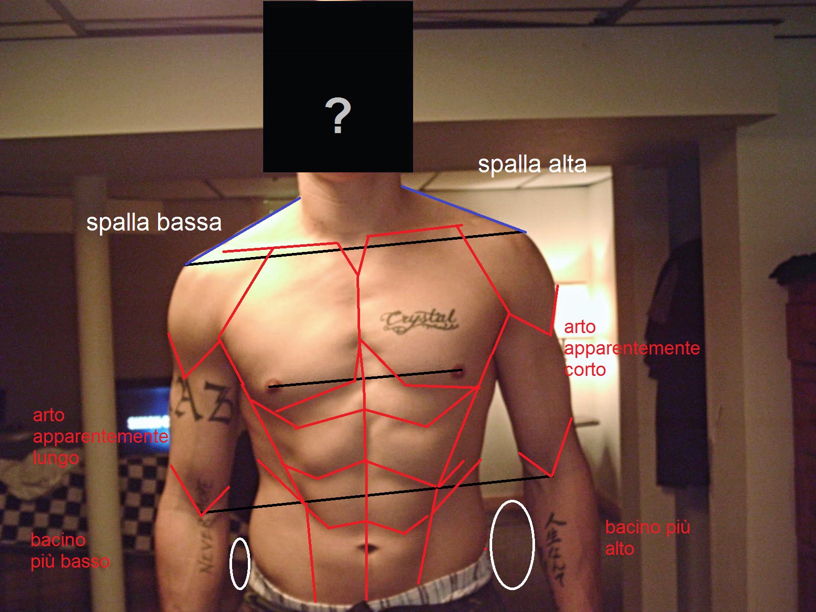 Sei sportivo ma la tua postura di crea problemi? Dolori muscolari, fatica e poca possibilità di aumentare la tua prestazione? Chiedi del metodo osteopatico STRAIN COUNTERSTRAIN