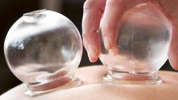 La coppettazione come metodo di detox dei tessuti e muscoli
